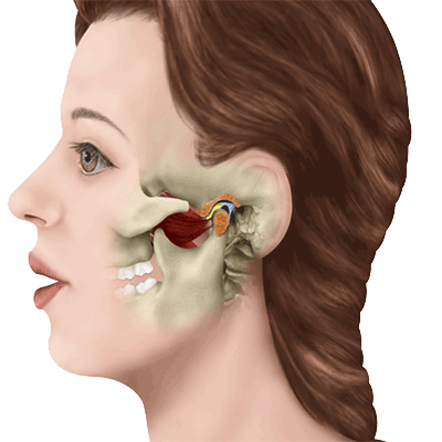سندرم مفصل گیجگاهی فکی (TMJ)