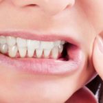 دندان قروچه چگونه درمان میشود؟