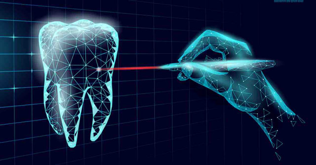 مزایای روش کاشت دندان با لیزر