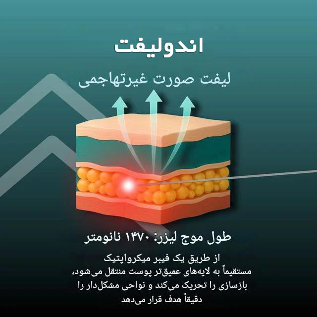 اندولیفت چیست؟