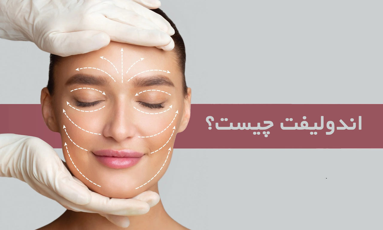 اندولیفت چیست و چقدر ماندگاری دارد؟