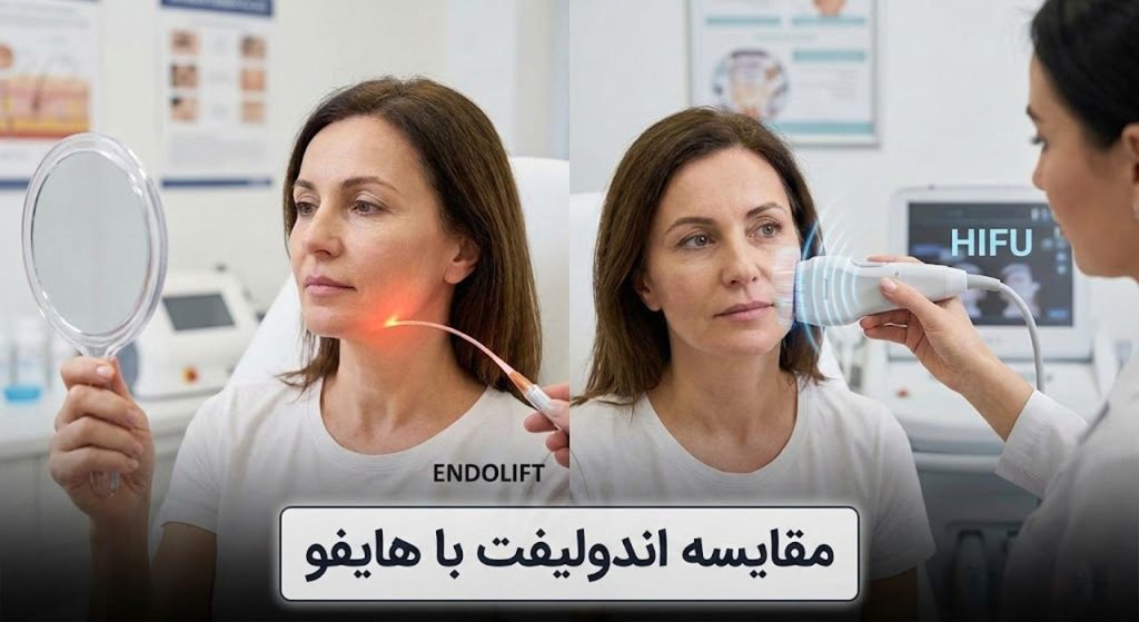 تفاوت‌های کلیدی اندولیفت و هایفو