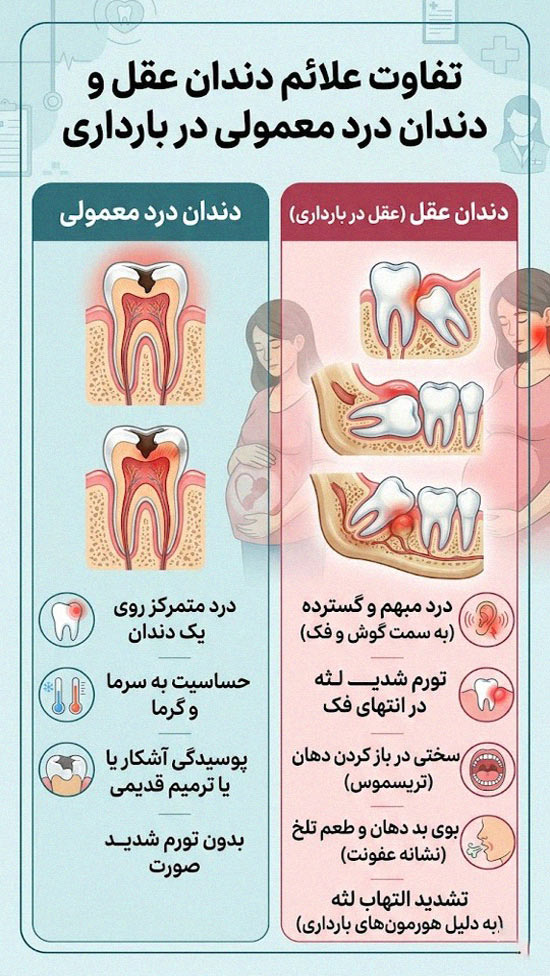مراحل تصمیم گیری برای کشیدن دندان عقل در بارداری
