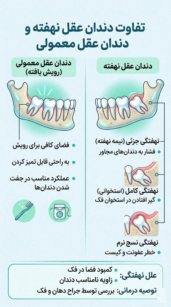 تفاوت دندان عقل نهفته و دندان عقل معمولی
