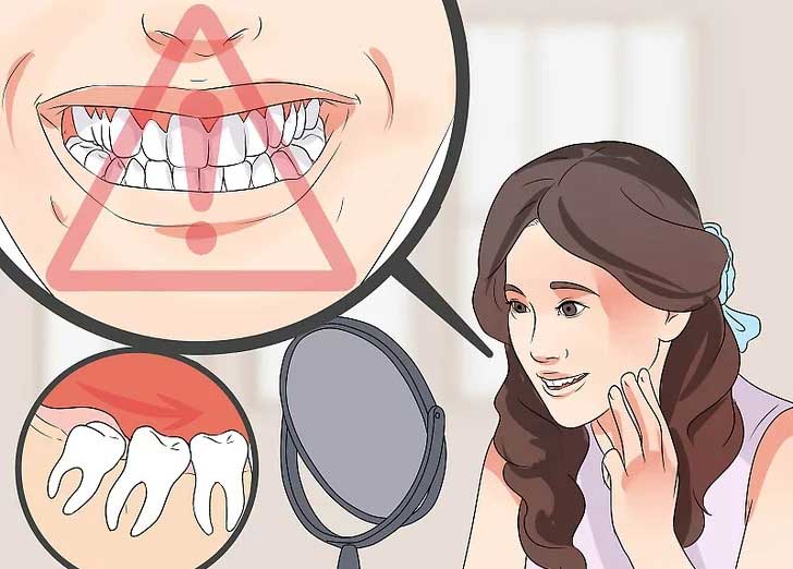 دندانهای جلویی را از نظر کج شدن بررسی کنید