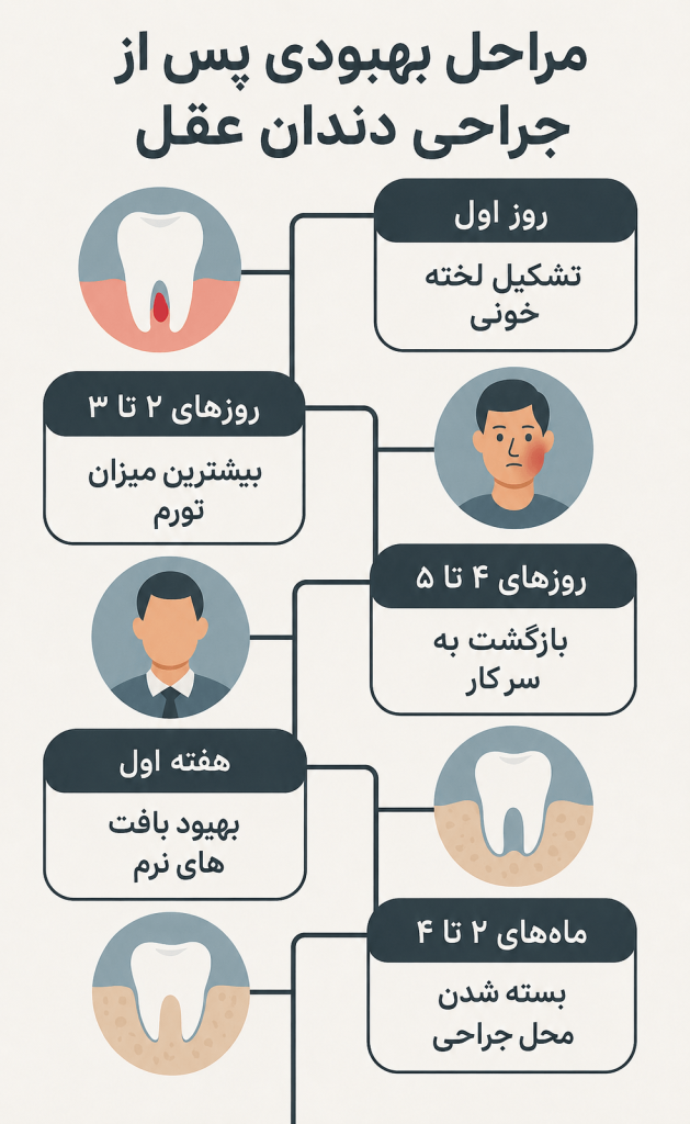 مراحل بهبودی پس از جراحی دندان عقل