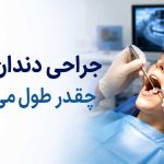 جراحی دندان عقل چقدر طول میکشد؟ از عمل تا بهبودی