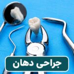 جراحی دهان و دندان | کلینیک تخصصی دکتر قاسم زاده در تهران