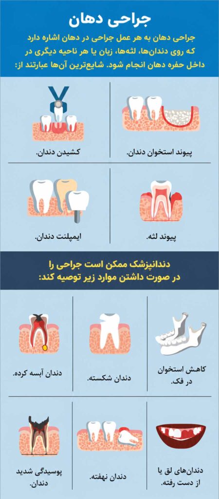 انواع جراحی دهان و دندان