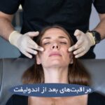 مراقبتهای بعد از اندولیفت + راهنمای ساده و به روز